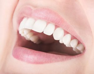 Cosmetic Dentistry Scottsdale, AZ - Implant Dentist - Smile Makeover