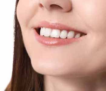 Image of a Young lady showing her straighter teeth