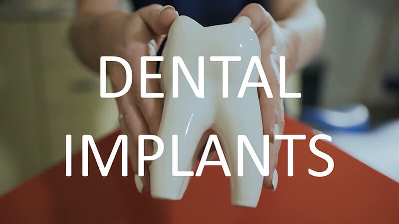Dr Rogel Carlos - Dental Implants
