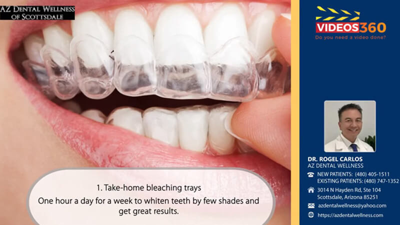 Teeth whitening procedure at AZ Dental Wellness explained by Dr. Rogel Carlos