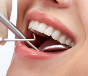 Effective Way to Whiten Teeth at AZ Dental Wellness in Scottsdale AZ Area
