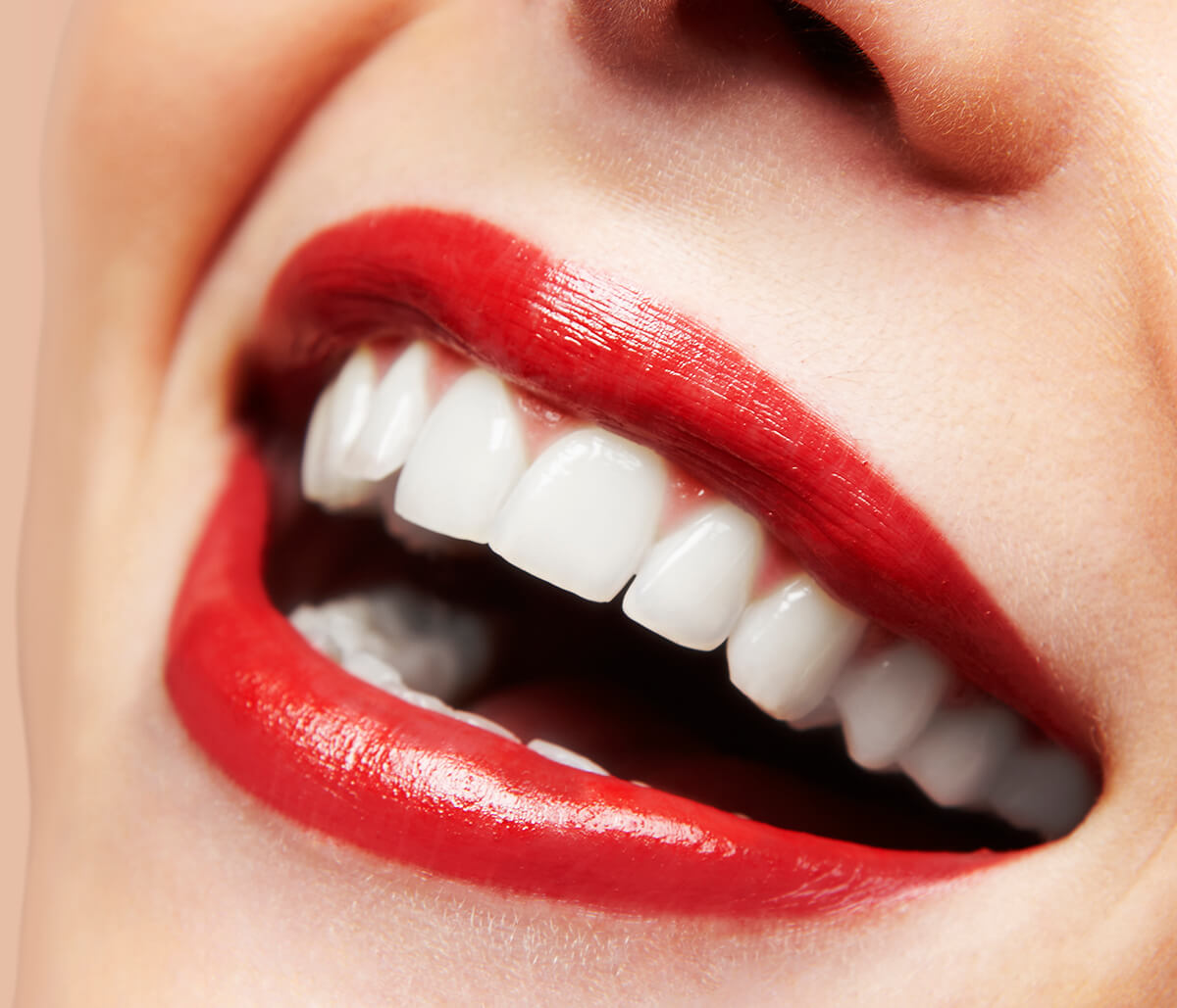 Veneers Cost at AZ Dental Wellness in Scottsdale Area