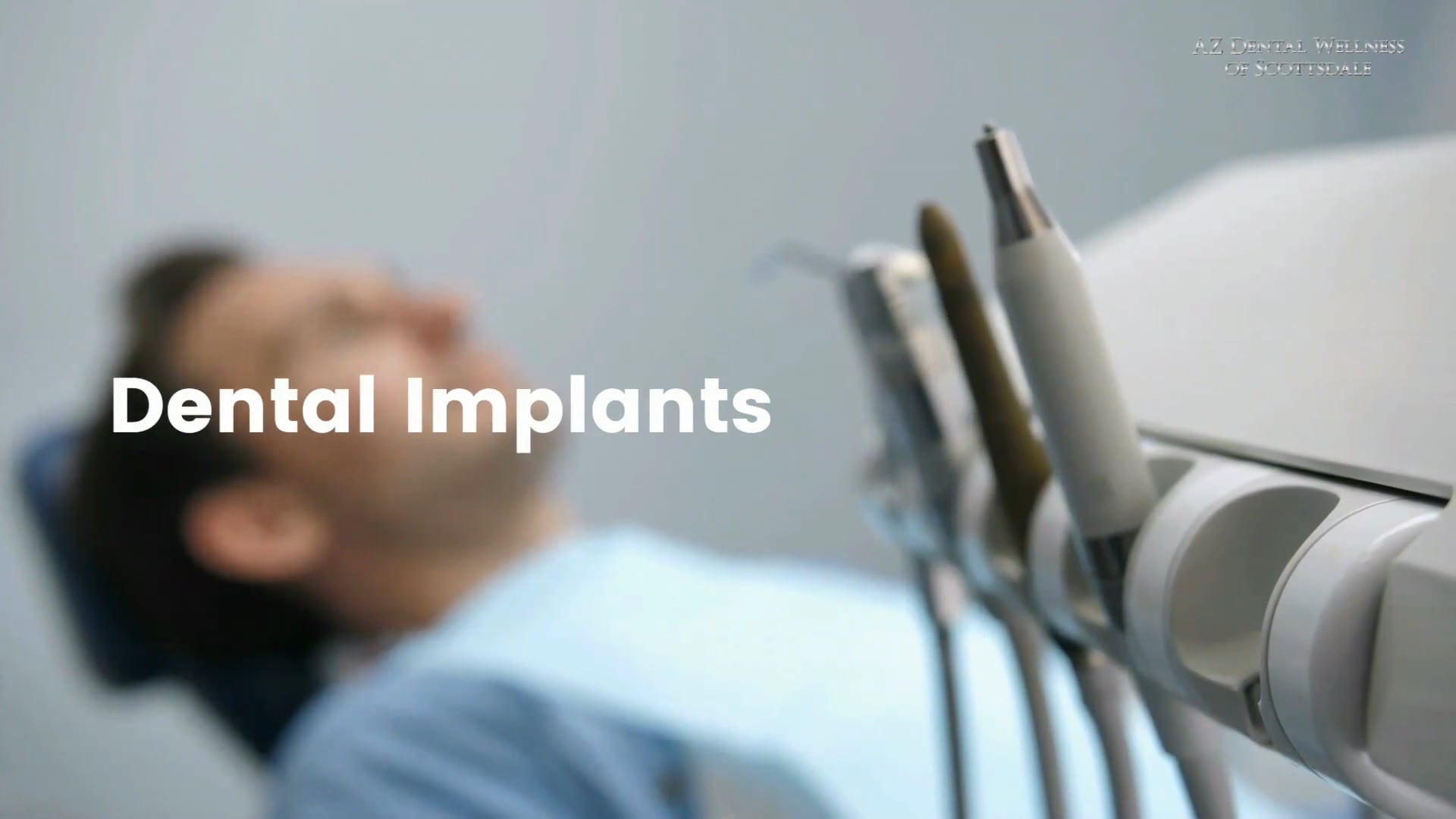Dental implants